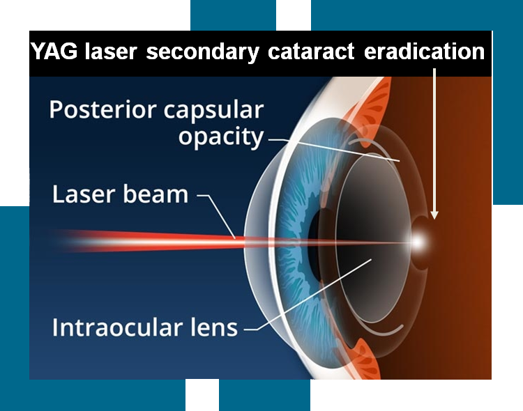 National Foundation for Eye Research