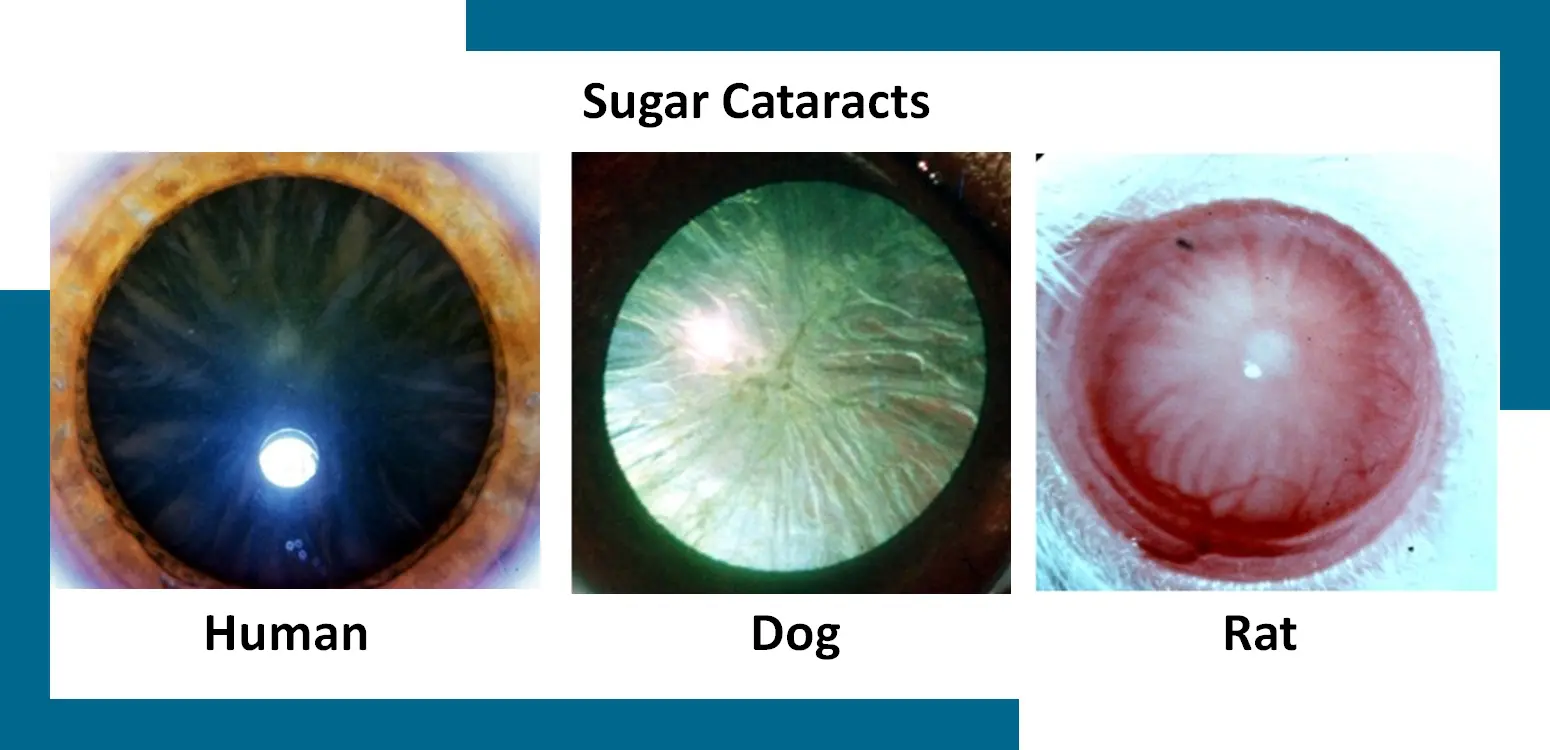 Cataract Research Organization National Foundation For Eye Research